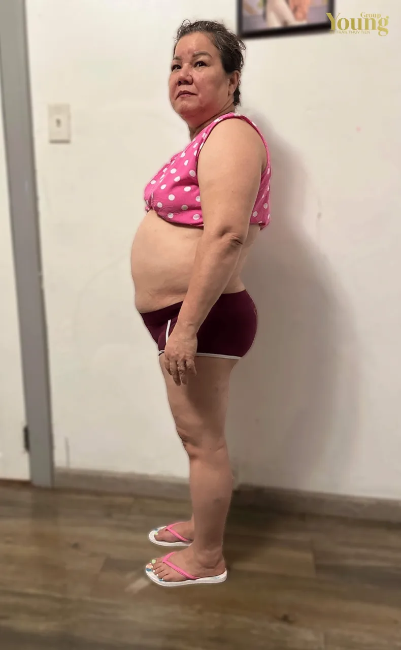 Chị Linda Ritchie trước và sau khi giảm 40 pound, ảnh trước