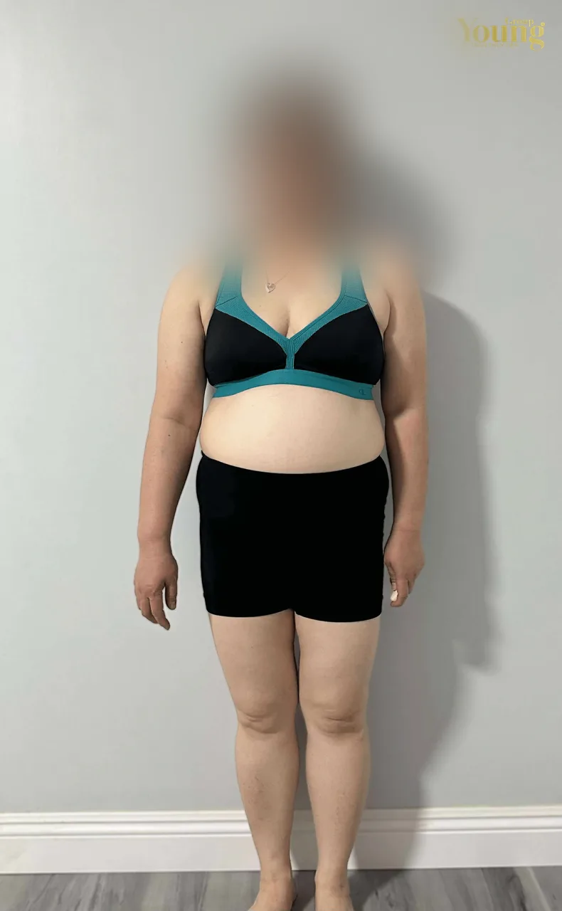 Chị Nhi Nguyen trước và sau khi giảm 36.4 pound (đã che mặt), ảnh trước