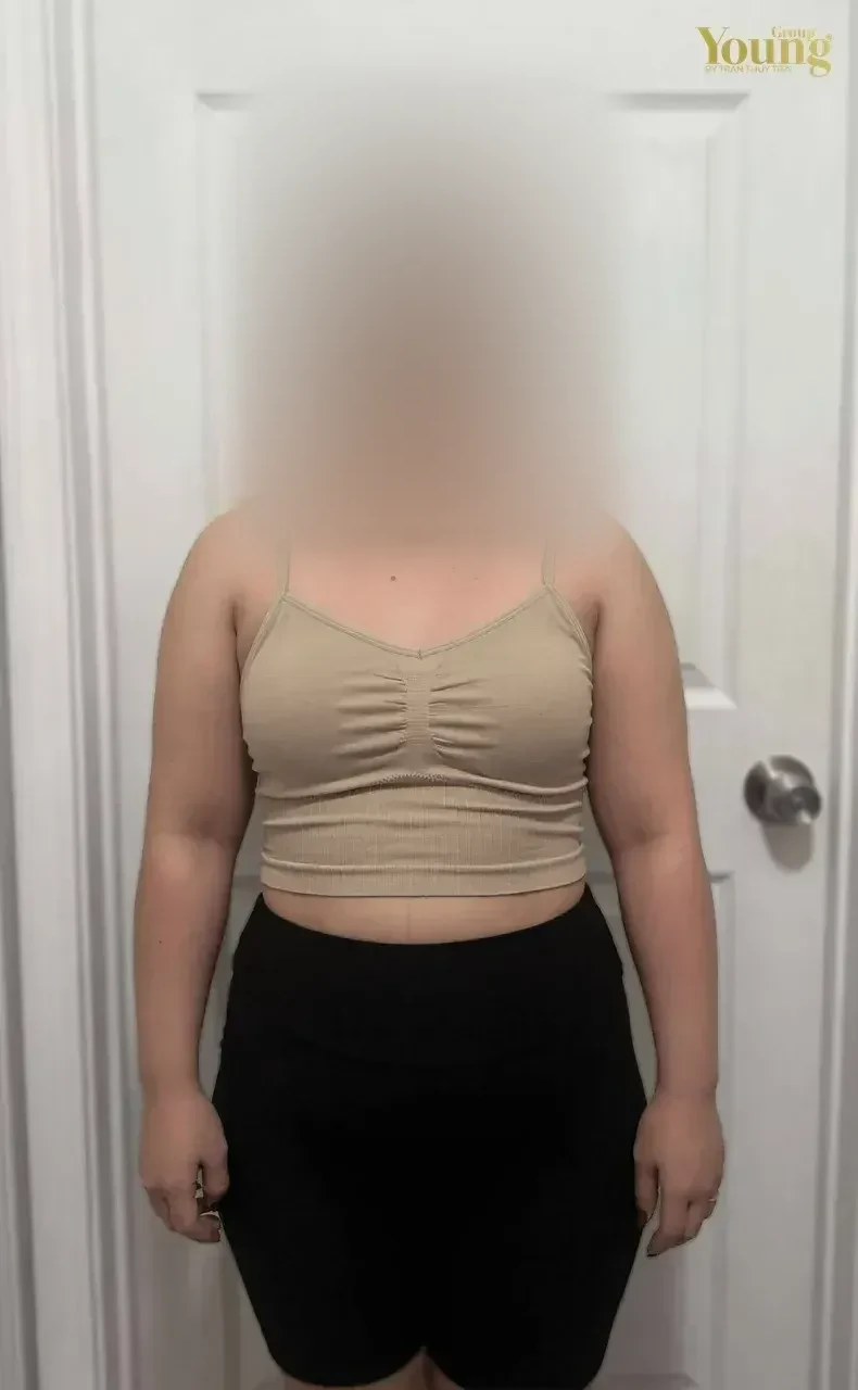 Chị Nina Phan trước và sau khi giảm 25 pound (đã che mặt), ảnh trước