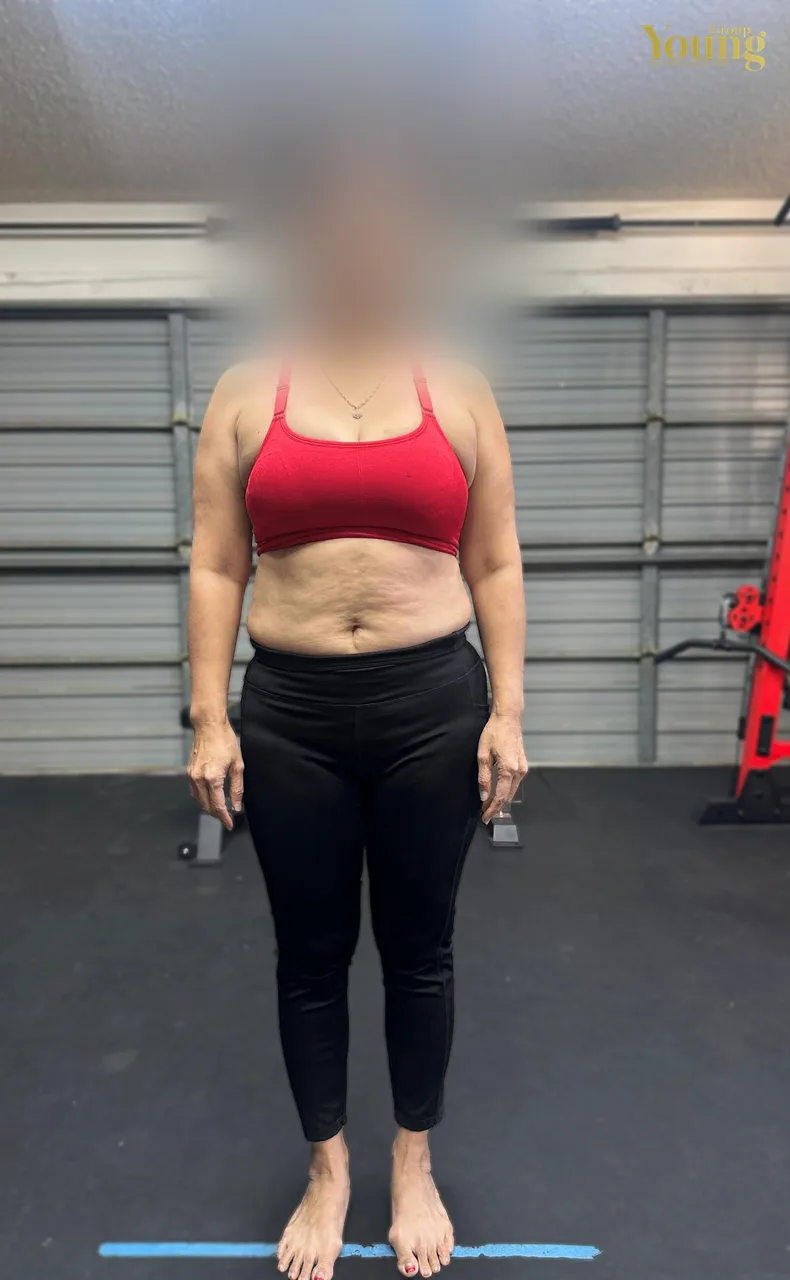 Chị Vivian Nguyen trước và sau khi giảm 22 pound (đã che mặt), ảnh trước
